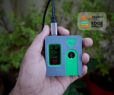 用FireBeetle ESP32-S3自制AI血氧仪，解锁健康监测新技能！
