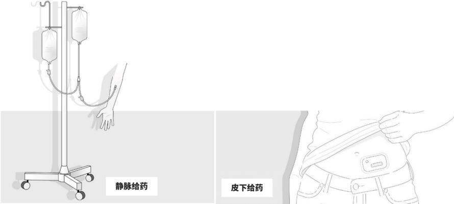 流量传感器在医疗中的应用 | “皮下给药”的正确打开方式1