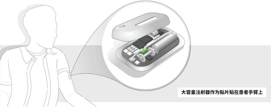流量传感器在医疗中的应用 | “皮下给药”的正确打开方式2